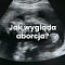 aborcjawyglad's Avatar